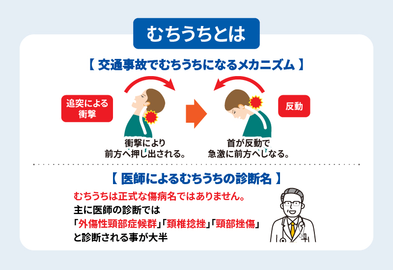 むちうちとは